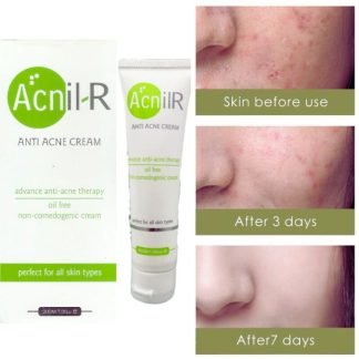 AcnilR Anti Acne Cream - HomeoPathyBaba.com