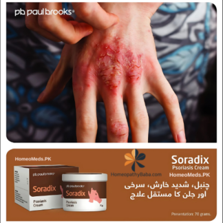 Soradix Psoriasis Cream 70gm